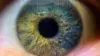 Optimec Malvern Hills Eye